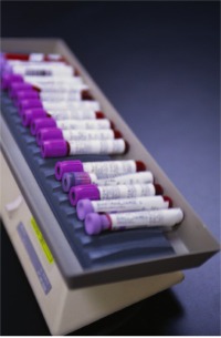 Blood vials.